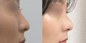 �����丮 �����