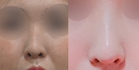 �����丮 �����