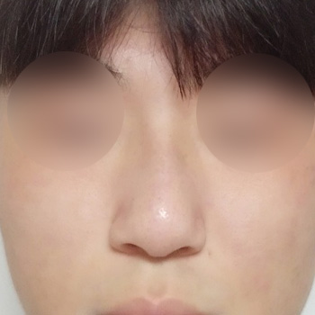 �����丮 �����