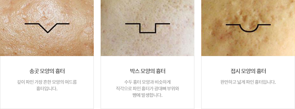 ���帧 ���Ͱ���