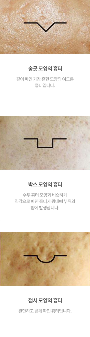 ���帧 ���Ͱ���