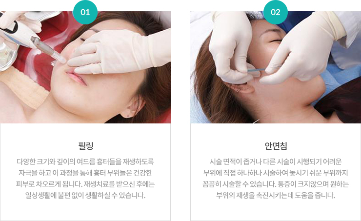 ���帧 ����ġ��