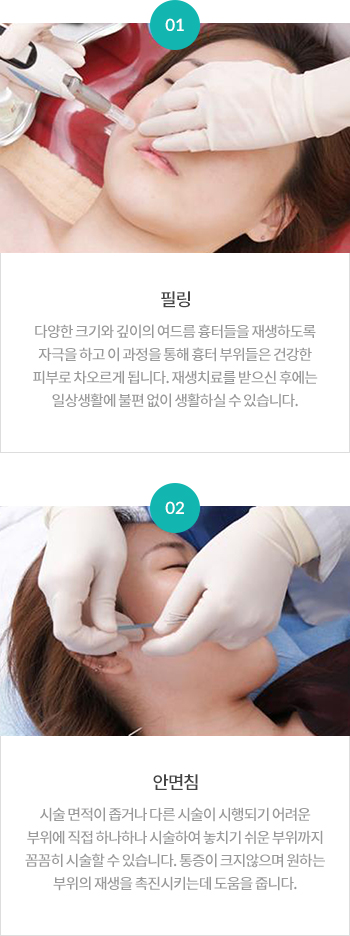 ���帧 ����ġ��